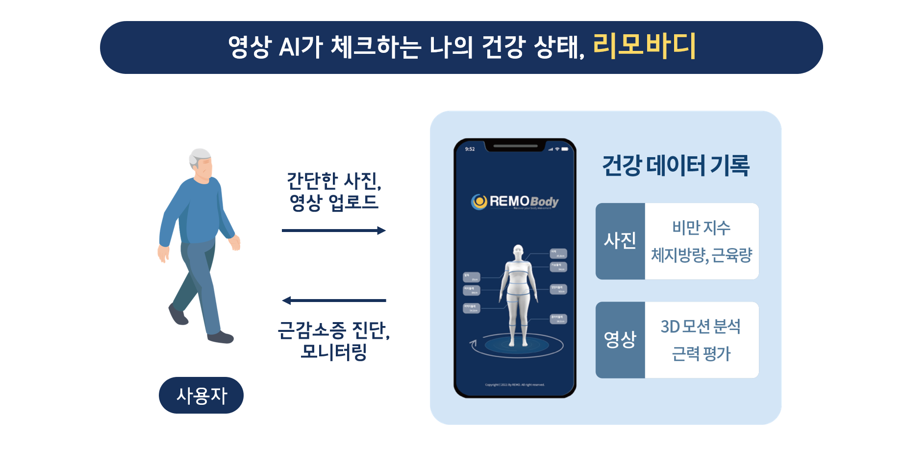 wowtale.net remo 1 1 - 와우테일