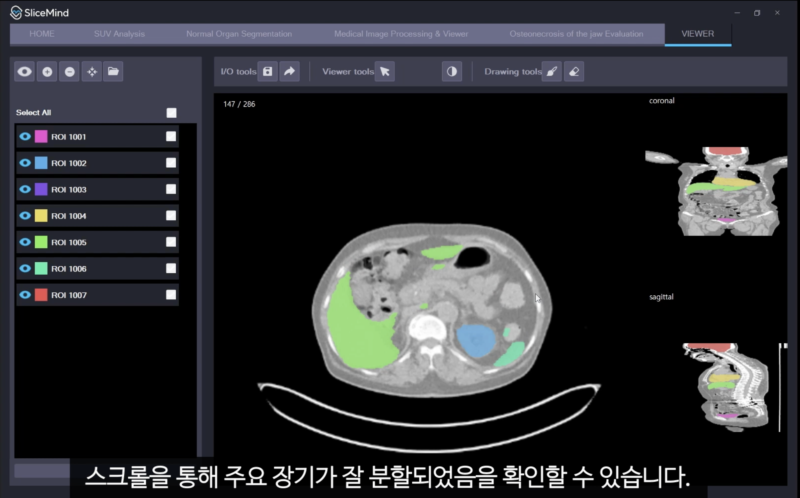 %EC%8A%A4%ED%81%AC%EB%A6%B0%EC%83%B7 2025 01 17 %EC%98%A4%ED%9B%84 8.53.19 - 와우테일