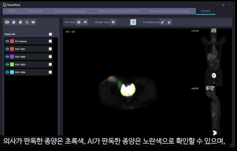 slicemind 1 - 와우테일